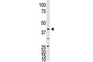 Image no. 1 for anti-Neuronal Differentiation 1 (NEUROD1) (C-Term) antibody (ABIN357406) (NEUROD1 Antikörper  (C-Term))
