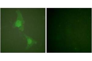 Immunofluorescence analysis of HeLa cells, using ADD1 (Ab-726) Antibody. (alpha Adducin Antikörper  (AA 688-737))