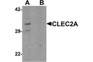 Western blot analysis of CLEC2A in K562 cell lysate with CLEC2A Antibody  at 1 ug/ml in (A) the absence and (B) the presence of blocking peptide. (CLEC2A Antikörper  (N-Term))