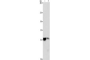 Gel: 8 % SDS-PAGE, Lysate: 40 μg, Lane 1-2: Mouse liver tissue, Mouse kidney tissue, Primary antibody: ABIN7128351(ALDH8A1 Antibody) at dilution 1/550, Secondary antibody: Goat anti rabbit IgG at 1/8000 dilution, Exposure time: 3 seconds