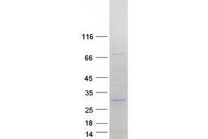 Western Blotting (WB) image for Slow Skeletal Troponin I (TNNI1) protein (Myc-DYKDDDDK Tag) (ABIN2732109)