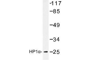 Image no. 1 for anti-Chromobox Homolog 5 (CBX5) antibody (ABIN272193) (CBX5 Antikörper)