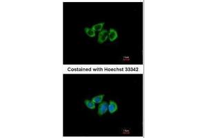 ICC/IF Image Immunofluorescence analysis of methanol-fixed A549, using RPL3, antibody at 1:500 dilution. (RPL3 Antikörper)