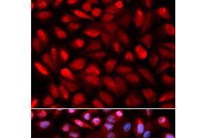 Immunofluorescence analysis of U2OS cells using PCBP2 Polyclonal Antibody (PCBP2 Antikörper)