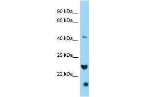 WB Suggested Anti-IZUMO4 Antibody Titration: 1. (IZUMO4 Antikörper  (C-Term))