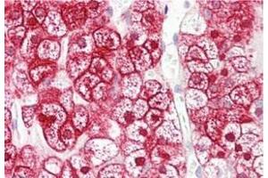 Human Adrenal: Formalin-Fixed, Paraffin-Embedded (FFPE) (SLC16A12 Antikörper)