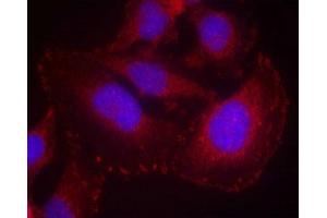 Immunofluorescence staining of methanol-fixed Hela cells using PLC-g1(phospho-Tyr771) Antibody. (Phospholipase C gamma 1 Antikörper  (pTyr771))