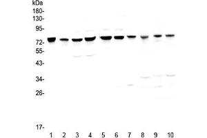 Western blot testing of human 1) HeLa, 2) placenta, 3) COLO-320, 4) HepG2, 5) PANC-1, 6) SGC-7901, 7) MBA-MD-231, 8) rat kidney, 9) mouse heart and 10) mouse kidney with PARN antibody at 0. (PARN Antikörper)