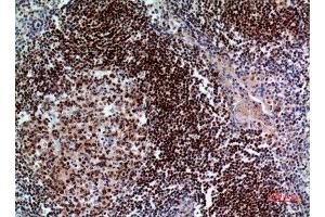 Immunohistochemistry (IHC) analysis of paraffin-embedded Human Tonsil, antibody was diluted at 1:100.