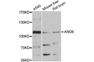 Western blot analysis of extracts of various cell lines, using ANO6 antibody (ABIN6291638) at 1:3000 dilution. (Anoctamin 6 Antikörper)