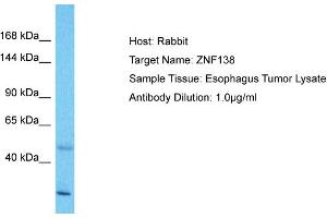 Host: Rabbit Target Name: ZNF138 Sample Type: Esophagus Tumor lysates Antibody Dilution: 1. (ZNF138 Antikörper  (Middle Region))