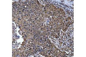 IHC analysis of PSMB4 using anti-PSMB4 antibody (ABIN7600532).