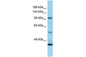 Image no. 1 for anti-Receptor Tyrosine Kinase-Like Orphan Receptor 1 (ROR1) (AA 155-204) antibody (ABIN6748473) (ROR1 Antikörper  (AA 155-204))