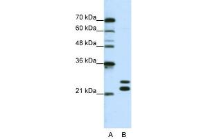CSDC2 Antikörper  (N-Term)