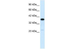 C4BPB antibody used at 1 ug/ml to detect target protein. (C4BPB Antikörper  (N-Term))