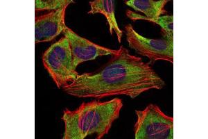 Immunofluorescence analysis of Hela cells using NEFL mouse mAb (green).