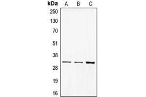 Western blot analysis of CD40 expression in BJAB (A), A431 (B), Ramos (C) whole cell lysates. (CD40 Antikörper  (C-Term))