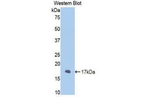 Western Blotting (WB) image for anti-Fibrinogen beta Chain (FGB) (AA 29-118) antibody (ABIN1858856) (Fibrinogen beta Chain Antikörper  (AA 29-118))