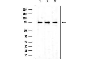 anti-Tudor Domain Containing 3 (TDRD3) antibody