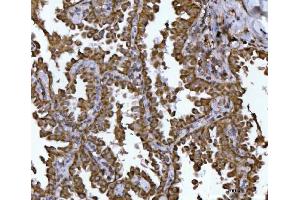 IHC analysis of NDUFS2 using anti-NDUFS2 antibody (ABIN7599417).