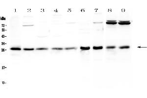 Western blot analysis of RAB27A using anti-RAB27A antibody . (RAB27A Antikörper  (AA 98-216))