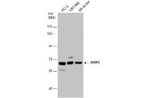 WB Image MMP2 antibody detects MMP2 protein by western blot analysis. (MMP2 Antikörper)