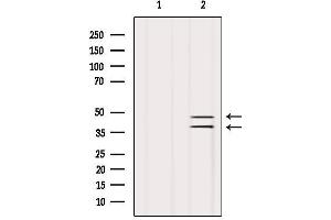 Western blot analysis of extracts from Hela, using SUGT1 Antibody. (SUGT1 Antikörper  (C-Term))