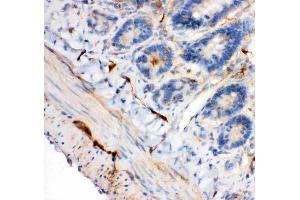 Anti-IRS1 antibody, (ABIN3043251), IHC(P)IHC(P): Rat Intestine Tissue (IRS1 Antikörper  (AA 1041-1242))