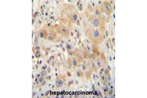 Immunohistochemistry (Paraffin-embedded Sections) (IHC (p)) image for anti-Nuclear Receptor Subfamily 0, Group B, Member 2 (NR0B2) (AA 56-83), (Middle Region) antibody (ABIN953745)
