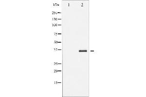 Western blot analysis of I kappaB beta phosphorylation expression in TNF-a treated 293 whole cell lysates,The lane on the left is treated with the antigen-specific peptide. (NFKBIB Antikörper  (pSer19))