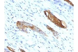 anti-ABO, Blood Group A Antigen antibody