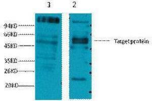 Western Blotting (WB) image for anti-Fc Fragment of IgE, Low Affinity II, Receptor For (CD23) (FCER2) antibody (ABIN3181152) (FCER2 Antikörper)