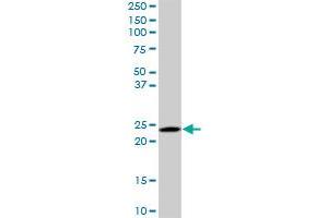 Western Blotting (WB) image for anti-RAB6A, Member RAS Oncogene Family (RAB6A) (AA 109-208) antibody (ABIN598568) (RAB6A Antikörper  (AA 109-208))