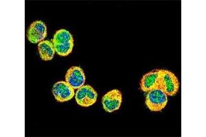 IF testing of AKT1 antibody with MDA-MB435 cells followed by Alexa Fluor 488-conjugated goat anti-rabbit lgG (green). (AKT1 Antikörper  (AA 115-144))