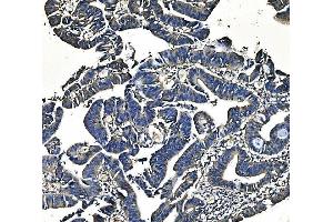IHC analysis of PCK2 using anti-PCK2 antibody (ABIN7599509). (PEPCK Antikörper  (AA 1-640))