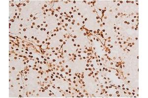 ABIN6267523 at 1/200 staining Rat kidney tissue sections by IHC-P. (SYK Antikörper  (pTyr348))