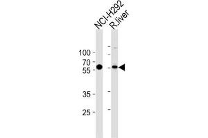 Western Blotting (WB) image for anti-Methylcrotonoyl-CoA Carboxylase 2 (Beta) (MCCC2) antibody (ABIN3002883) (MCCC2 Antikörper)