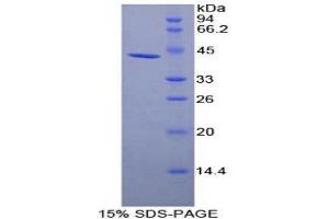 SDS-PAGE (SDS) image for Plasminogen Activator, Urokinase Receptor (PLAUR) (AA 221-305) protein (His tag,GST tag) (ABIN1171123) (PLAUR Protein (AA 221-305) (His tag,GST tag))