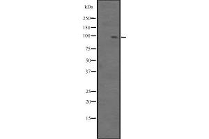 Western blot analysis of BCL11B expression in Jurkat cell lysate,The lane on the left is treated with the antigen-specific peptide. (BCL11B Antikörper  (Internal Region))