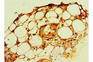 Immunohistochemistry of paraffin-embedded human trachea tissue using ABIN7168119 at dilution of 1:100 (POP7 Antikörper  (AA 1-140))