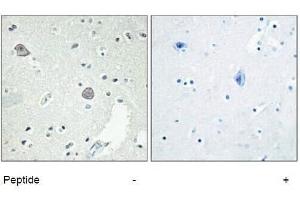 Immunohistochemical analysis of paraffin-embedded Human-Brian , antibody was diluted at 1:100. (D1DR Antikörper  (Internal Region))