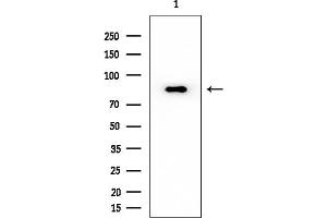 anti-Enoyl-CoA, Hydratase/3-Hydroxyacyl CoA Dehydrogenase (EHHADH) (Internal Region) antibody