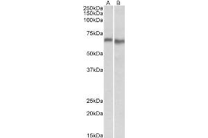 ABIN571224 (0. (PRKAA2 Antikörper  (Internal Region))