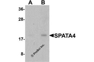 Western Blotting (WB) image for anti-Spermatogenesis Associated Protein 4 (SPATA4) (C-Term) antibody (ABIN1077367) (SPATA4 Antikörper  (C-Term))