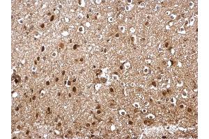 IHC-P Image SKP1 antibody detects SKP1 protein at cytosol and nucleus on mouse middle brain by immunohistochemical analysis. (SKP1 Antikörper)
