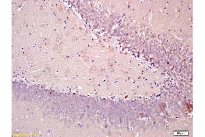 Immunohistochemistry (IHC) image for anti-Sema Domain, Immunoglobulin Domain (Ig), Transmembrane Domain (TM) and Short Cytoplasmic Domain, (Semaphorin) 4F (SEMA4F) (AA 239-288) antibody (ABIN1385844)
