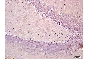 Formalin-fixed and paraffin embedded rat brain tissue labeled with Anti-SEMA4F Polyclonal Antibody, Unconjugated (ABIN1385844) at 1:200, followed by conjugation to the secondary antibody and DAB staining (SEMA4F Antikörper  (AA 239-288))