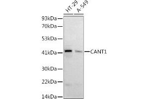 Western blot analysis of extracts of various cell lines, using (ABIN6128977, ABIN6137904, ABIN6137907 and ABIN6221957) at 1:1000 dilution. (CANT1 Antikörper  (AA 102-401))