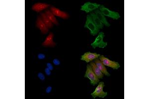 ABIN6257708 and ABIN6275404 staining Hela cells by IF/ICC. (FNTB Antikörper  (Internal Region))