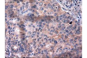 Image no. 2 for anti-Keratin 18 (KRT18) (AA 69-372) antibody (ABIN1491639) (Cytokeratin 18 Antikörper  (AA 69-372))